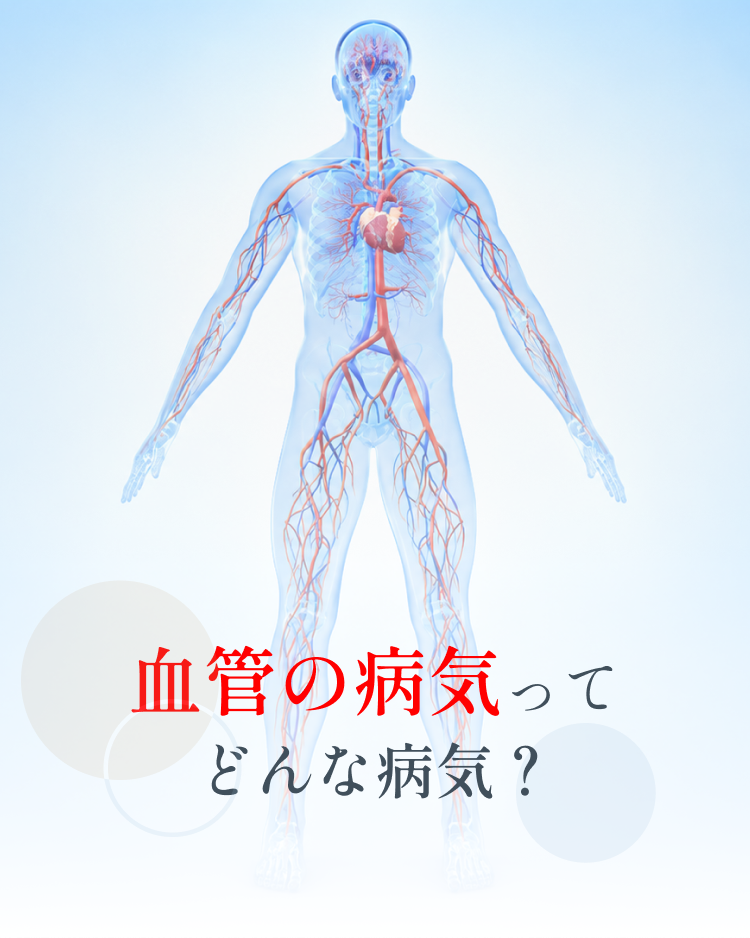 血管の病気ってどんな病気？ 動脈と静脈の役割と疾患を解説するコラム